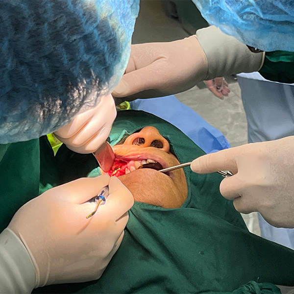 口腔種植手術(shù)近景觀看